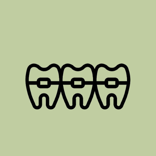 Kawat Gigi - Adora Dental Specialist Clinic