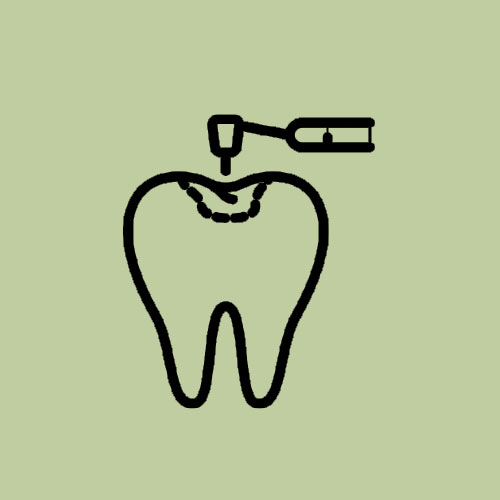 Tambal Gigi - Adora Dental Specialist Clinic